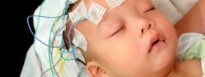 Sclerosi tuberosa: come affrontare la malattia